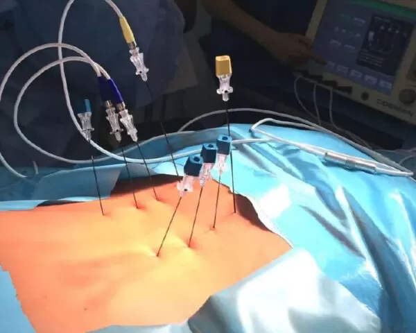 cronic8